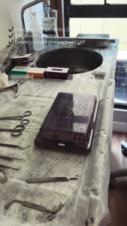implante dentario volta redonda odontomv acompanhamento pós-operatório